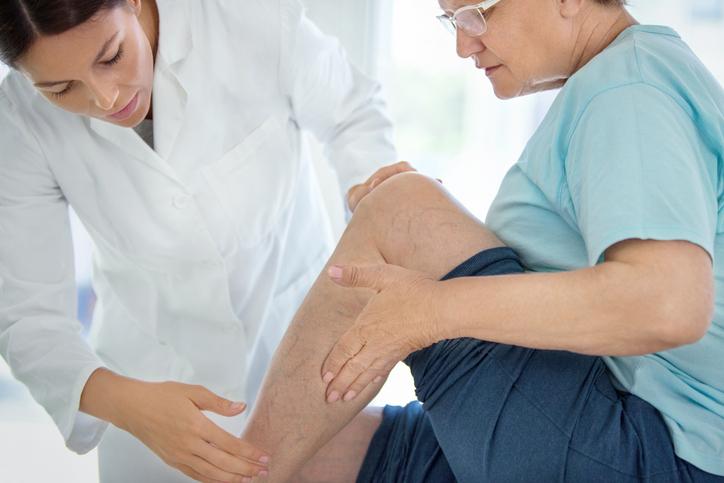 doctor looking at woman's leg