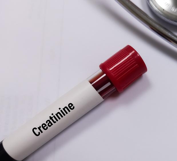 blood vial with creatinine label