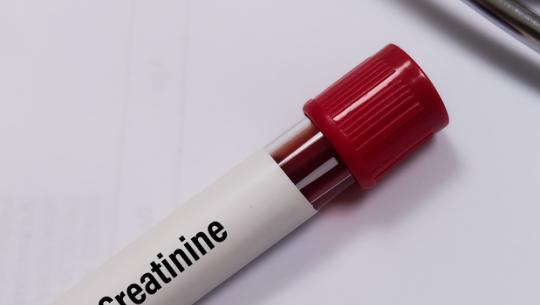 blood vial with creatinine label